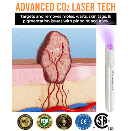 Laser-Stift für Hautunreinheiten – Präzise CO₂-Technologie -    Zorenza