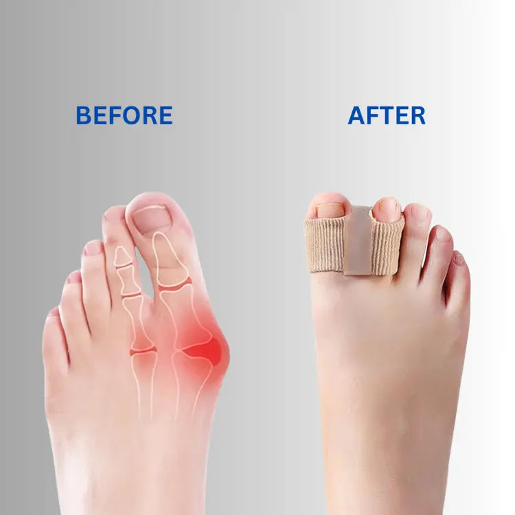 1 Paar + 2 Paren GRATIS VANDAAG | AlignToe™ Mivoza Deutschland