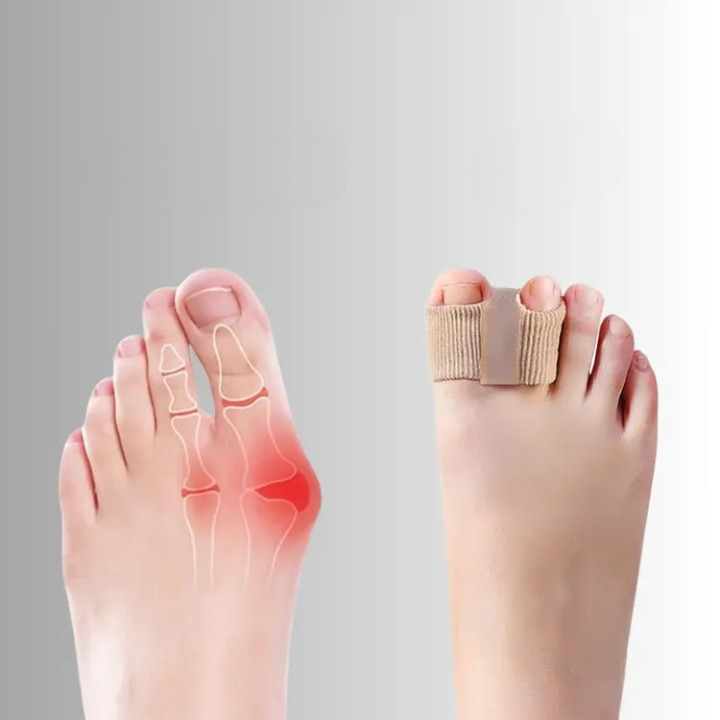 Zehenausrichter — Korrigiert Hallux & überlappende Zehen sanft -    Zorenza