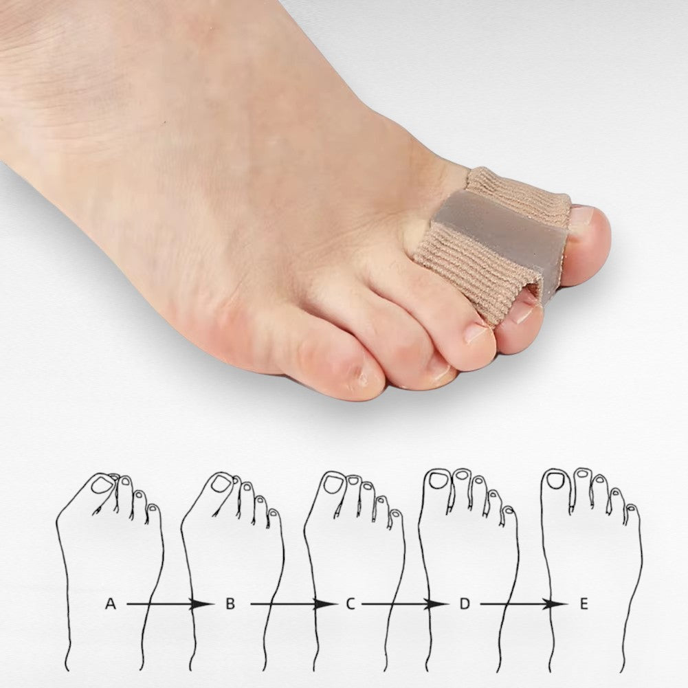 Zehenspreizer bei Hallux Valgus – Schmerzlinderung & Ausrichtung (1 Paar) -    Zorenza